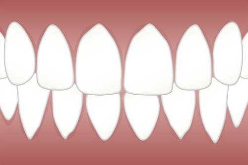 关于牙齿矫正，你还存在年龄的疑问吗？